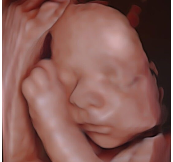 Échographie de la femme enceinte, Vidéothèque Y compris : ultrason et bébé  - Envato Elements